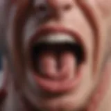 Close-up view of an aphthous ulcer inside the oral cavity
