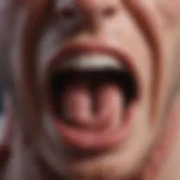 Close-up view of an aphthous ulcer inside the oral cavity