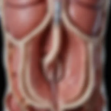 Diagram illustrating bladder anatomy with emphasis on lateral wall
