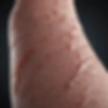 Collagen Gel in Clinical Wound Management Clinical setting of wound care using collagen gel