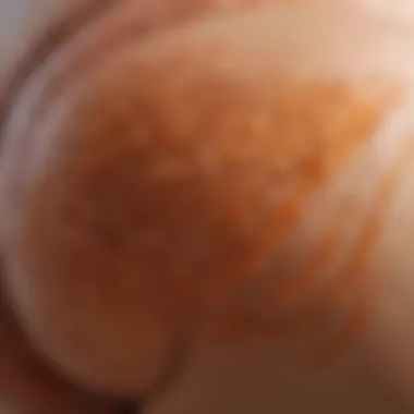 Scientific Illustration of Cellulite Formation Scientific illustration of cellulite formation