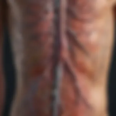 Illustration of lymphatic system highlighting affected areas in stage two Hodgkin's lymphoma