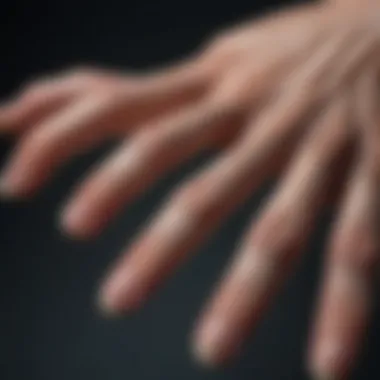 Illustration showing the anatomy of fingers affected by arthritis