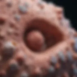 Microscopic view of infiltrative basal cell carcinoma