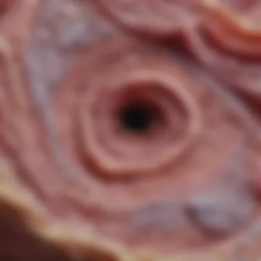 Histological Features of MBCC Histological examination of Morphoeic Basal Cell Carcinoma