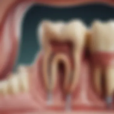 Factors Leading to Long-term Root Canal Infections Infographic showing common causes of root canal infections over time