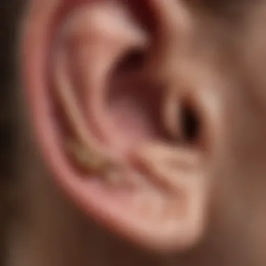 Close-up view of seborrheic dermatitis lesions in the ear canal