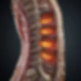 Illustration of spinal anatomy affected by stenosis