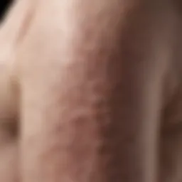 Close-up of psoriasis-affected skin