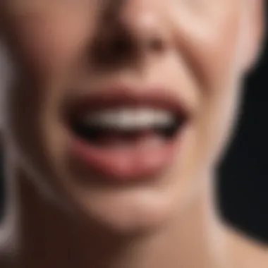 Treatment Options for Mouth Sores Chart outlining treatment options for mouth sores