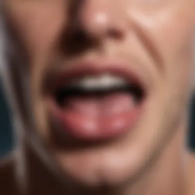 Clinical Symptoms Associated with Tongue Amyloidosis Clinical symptoms of tongue amyloidosis