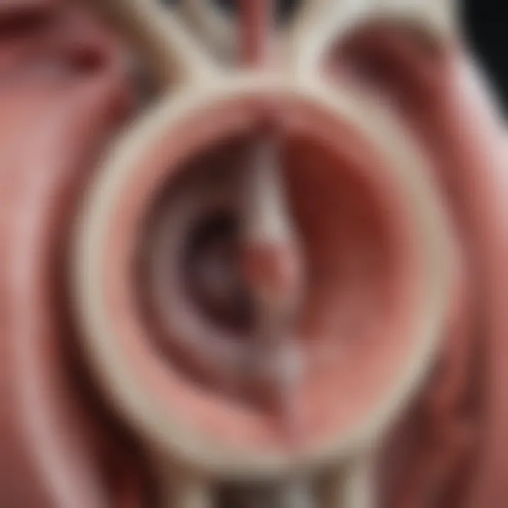 Illustration of the aortic valve anatomy