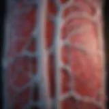 Radiological representation of SMA syndrome showing artery compression