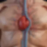 Diagram illustrating the pathophysiology of atrial fibrillation and its impact on stroke risk.