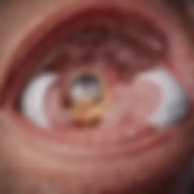 Diagnostic Techniques for Esophageal Cancer Diagnostic techniques used in identifying HPV-related esophageal cancer